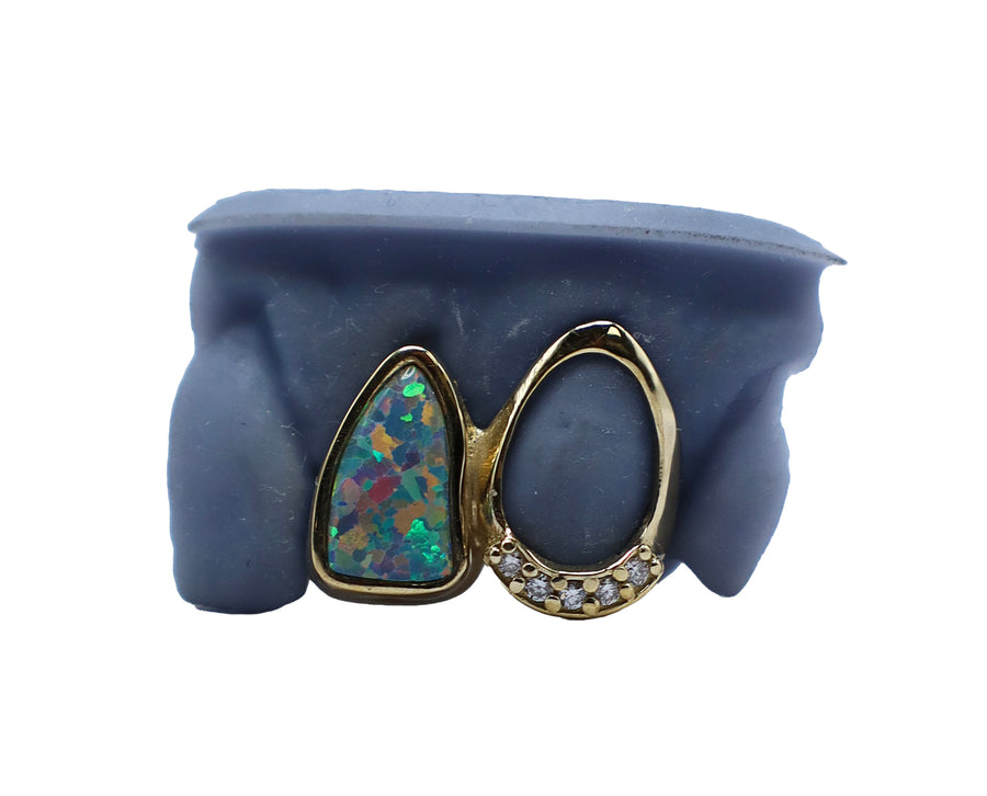 Opal Tooth w Open Face and Diamond Tip Grillz