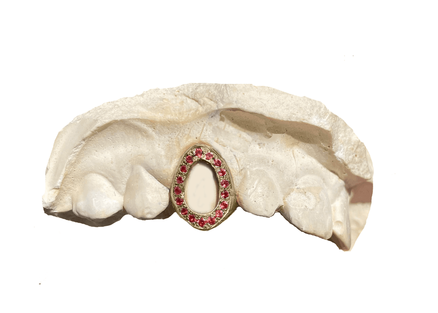 Red Ruby Open Face Grillz (14K, Yellow Gold)