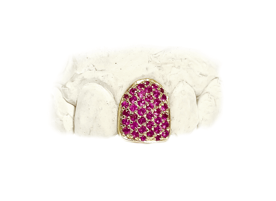 Single Tooth Grillz w Hot Pink Sapphires (14K, Yellow Gold)