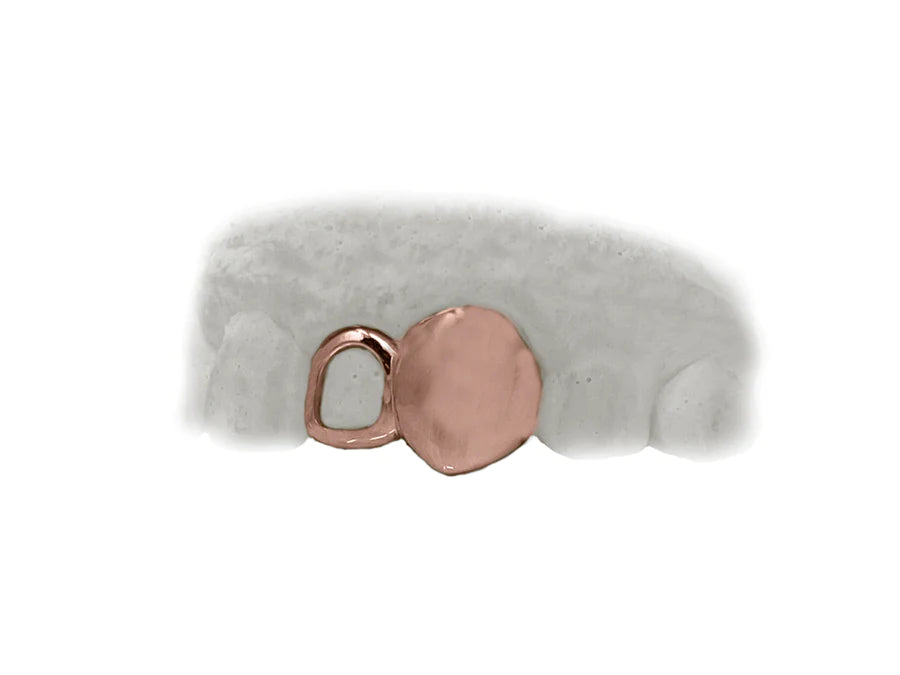 Top Two Teeth Open Face & Solid Fang Grillz (14K, Rose Gold)