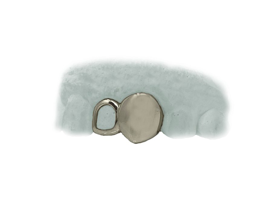 Top Two Teeth Open Face & Solid Fang Grillz (10K, White Gold)