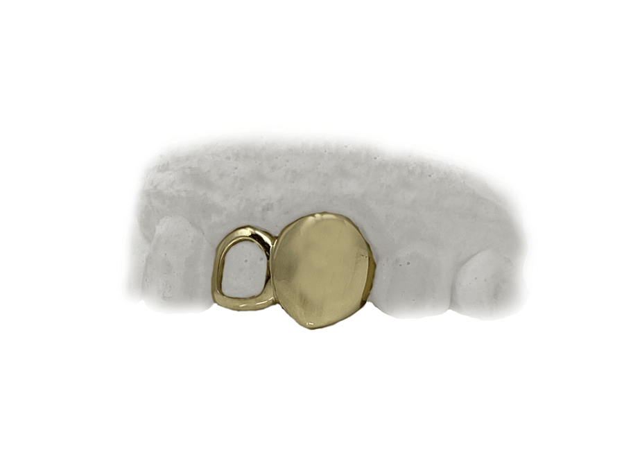 Top Two Teeth Open Face & Solid Fang Grillz (18K, Yellow Gold)