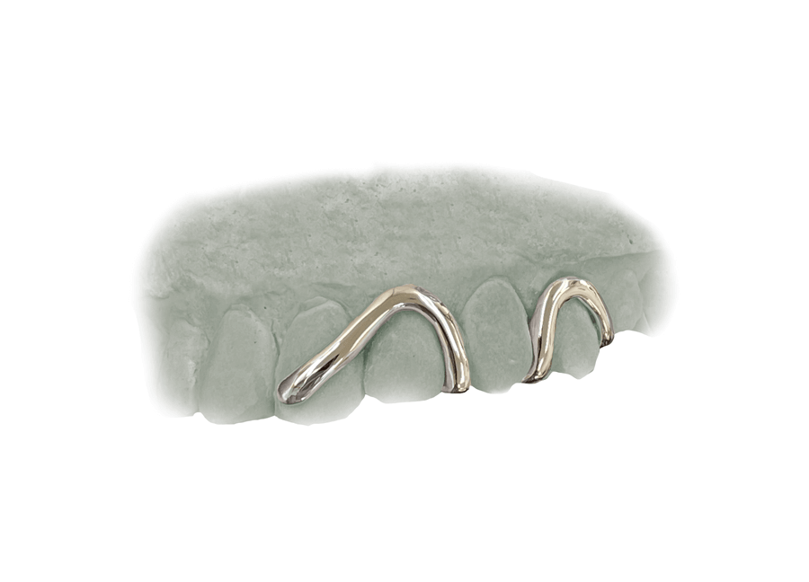 Top Wave Grillz (14K, White Gold)