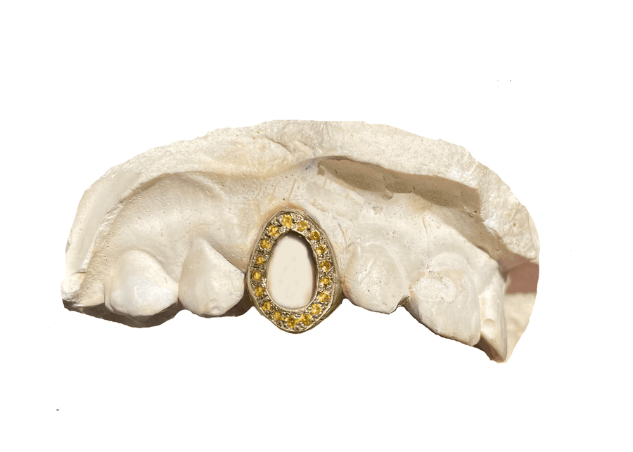 Yellow Sapphire Open Face Grillz (14K, Yellow Gold)