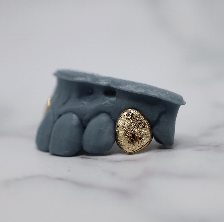 Hand Engraving (One Tooth)