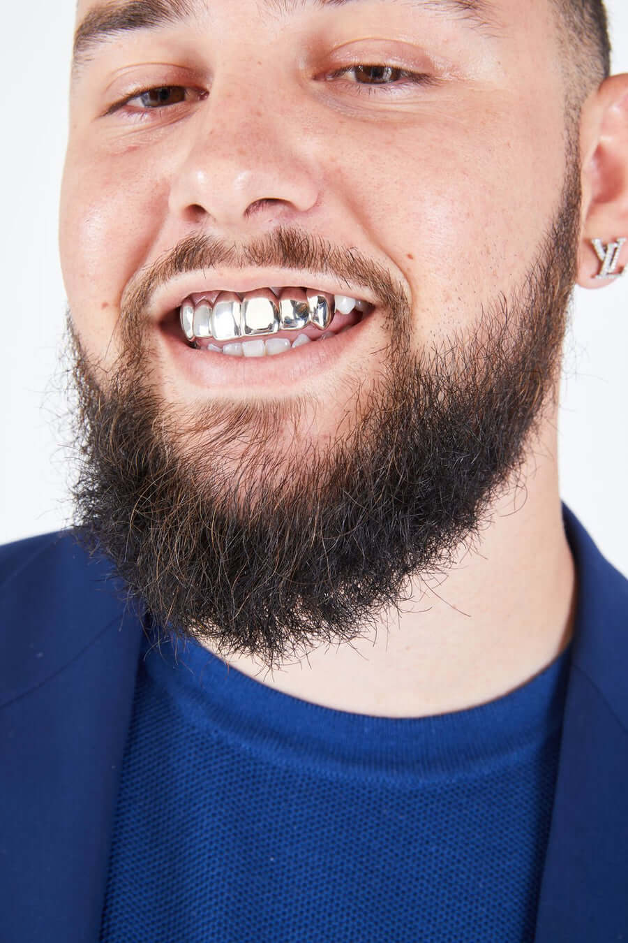 Top 6 Grillz (10K, Yellow Gold)