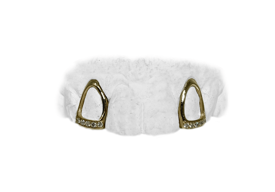 Open Face Teeth with Diamond Tips Grillz in 14K Yellow Gold