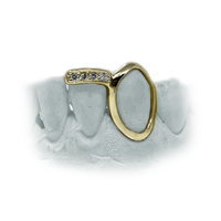 Two Teeth Grillz w Open Face Fang & Floating Diamond Tip