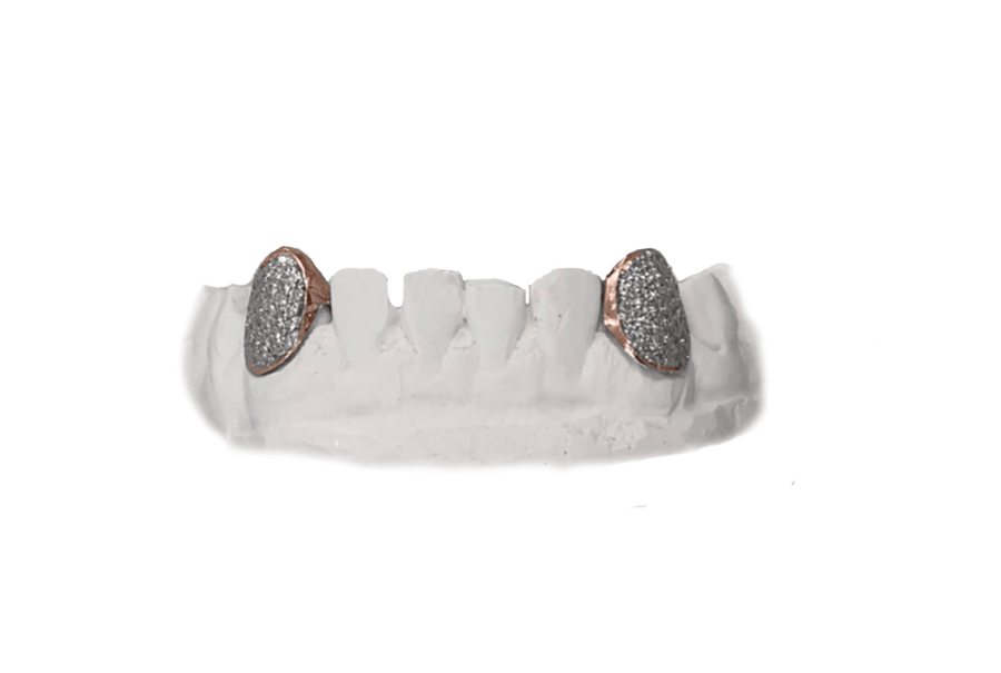 Bottom Diamond Fang Grillz (VS Diamonds, 14K Rose Gold)