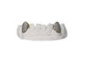 Diamond Fang Grillz - VS+ Diamonds 14K Yellow Gold