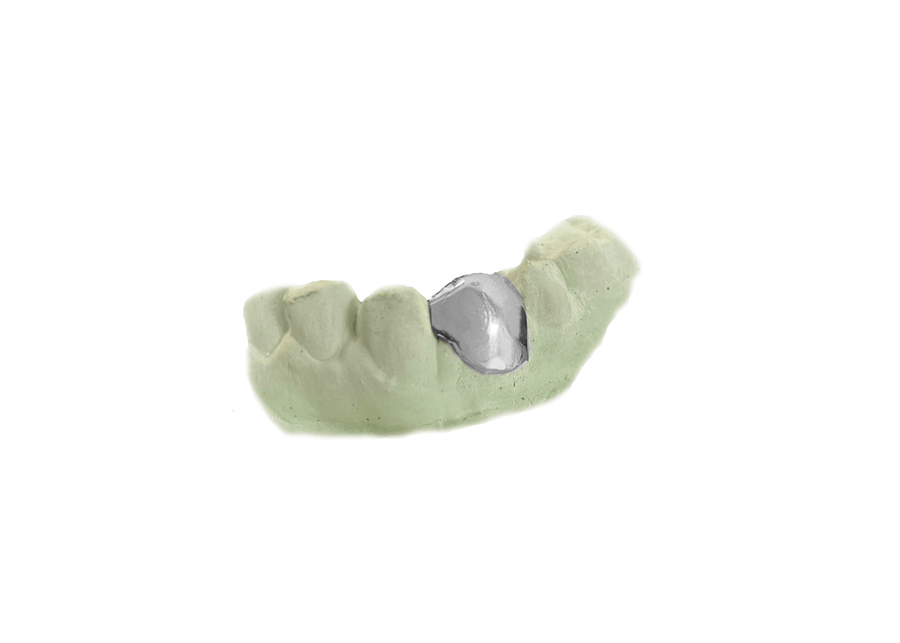 Bottom Single Tooth Grillz in 14K White Gold