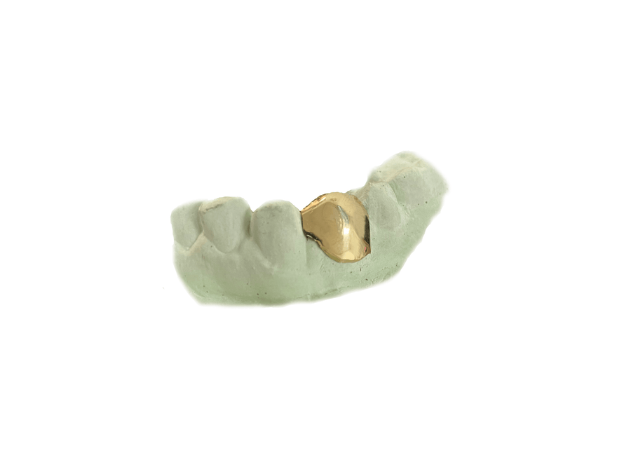 Bottom Single Tooth Grillz in 18K Yellow Gold