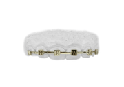 Top 6 Braces Grillz
