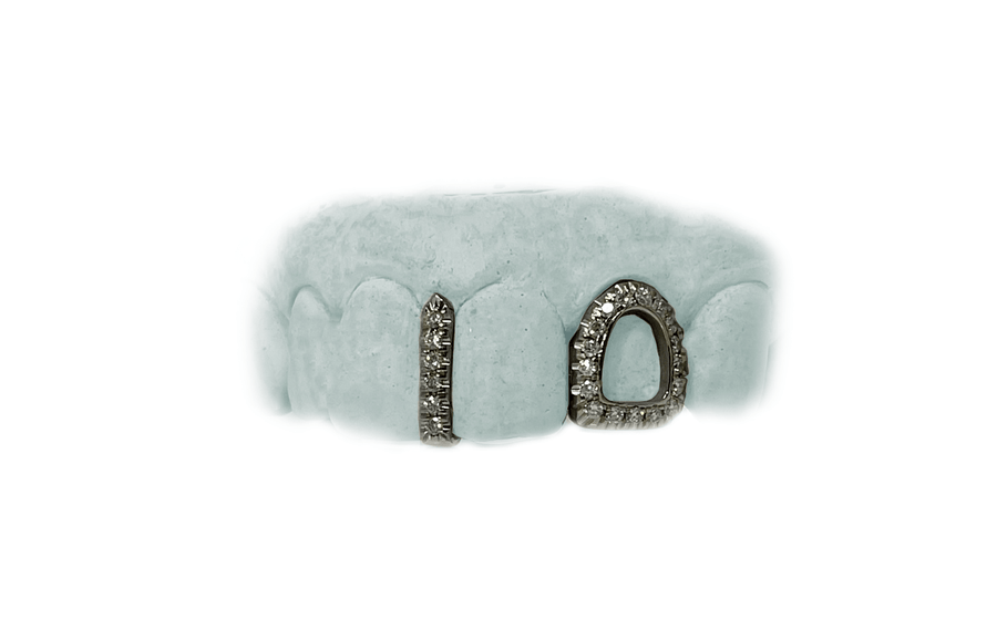 Diamond Gap Grillz and Diamond Open Face Tooth in White Gold