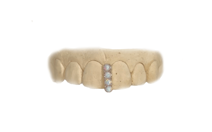 Opal Gap Grillz in 10K White Gold