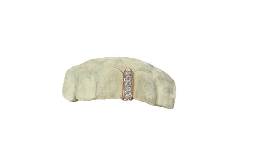 Gap Grillz with Diamonds 14K Rose Gold