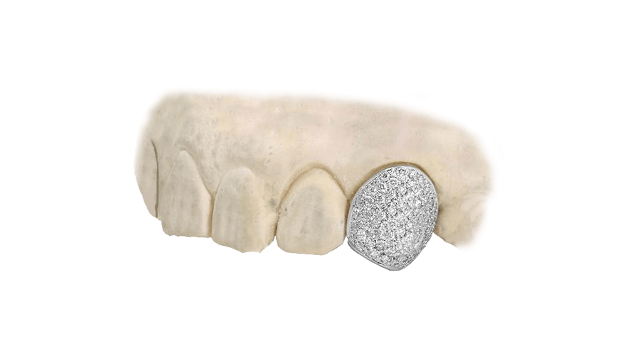 Diamond Tooth Single Cap 14K White Gold