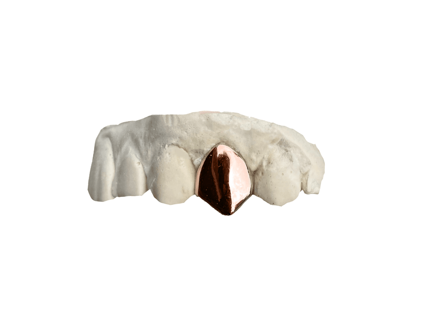 Single Tooth Grillz - Top Rose Gold 14K