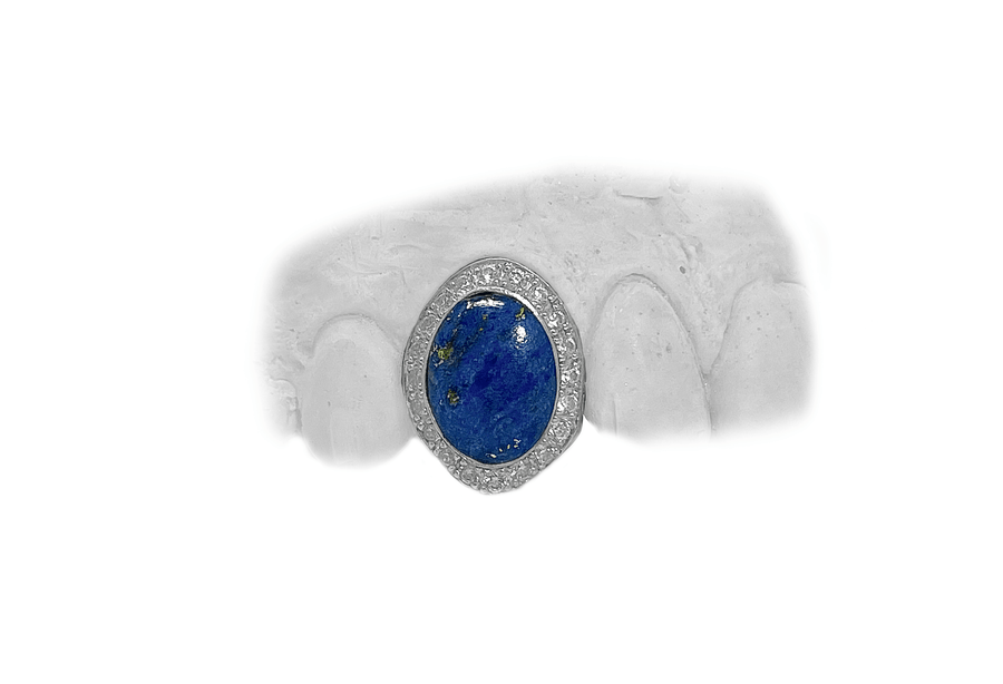 Lapis Grillz - Single Tooth with Diamond Halo in 10K White Gold