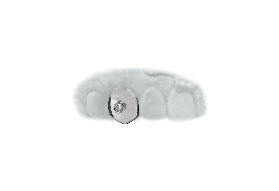 Single Tooth Grillz w Single Diamond in White Gold