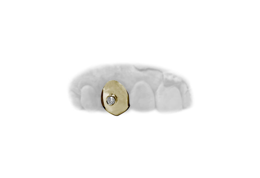 Single Tooth Grillz w Single Diamond in Yellow Gold