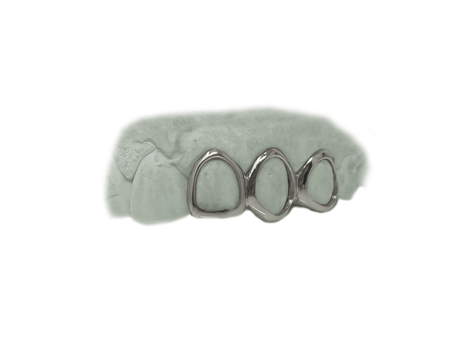 Top 3 Open Face Grillz in 14K White Gold