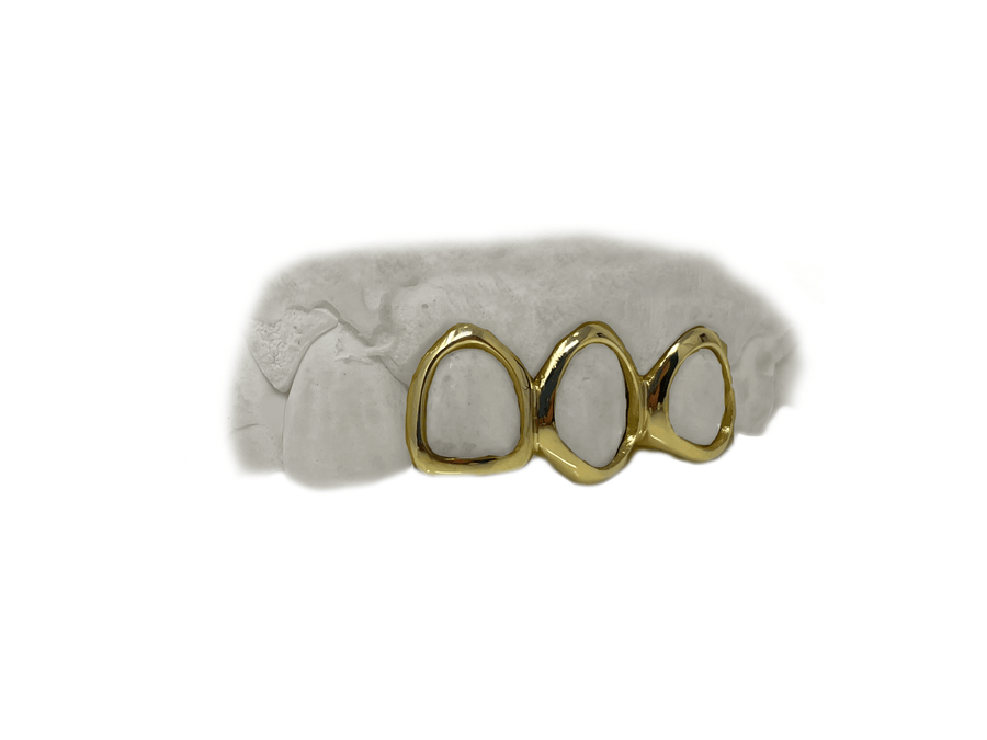 Top 3 Open Face Grillz in 14K Yellow Gold