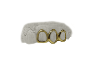 Top 3 Open Face Grillz in 10K Yellow Gold