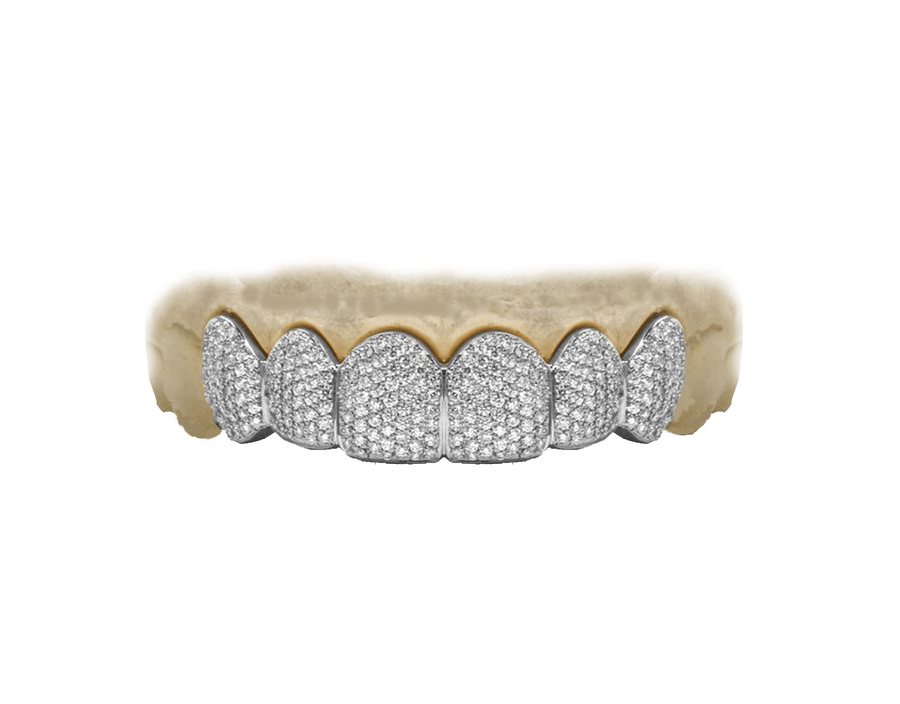 VVS Diamond Grillz - Top 6 White Gold 14K