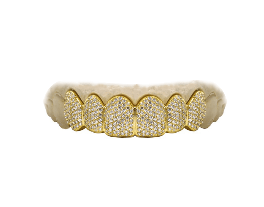 VVS Diamond Top 6 Grillz - Yellow Gold 14K