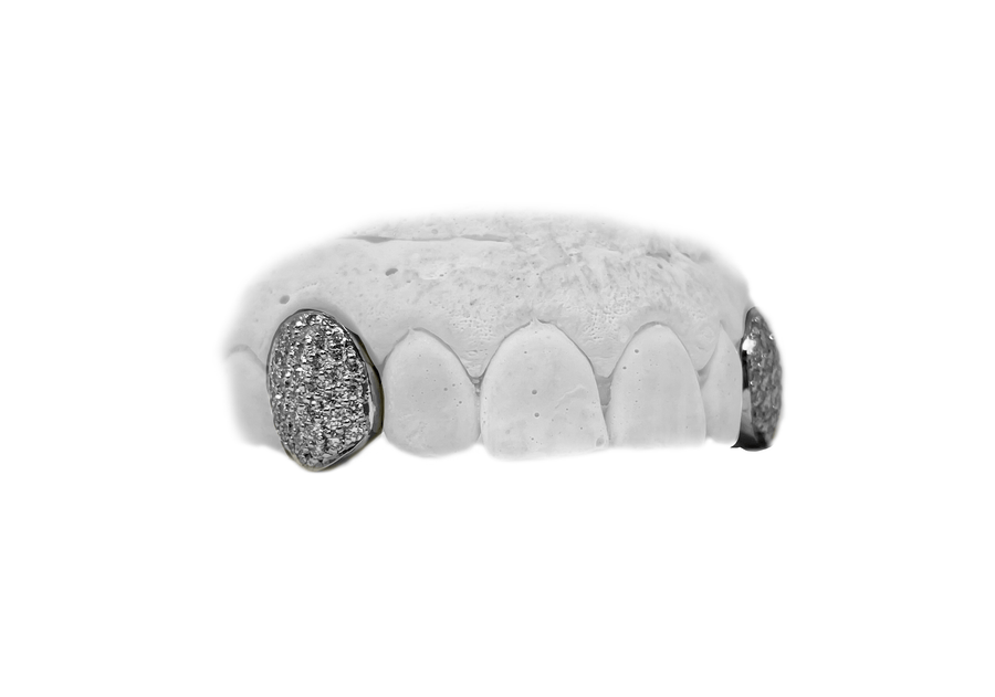 Top Diamond Fang Grillz in White Gold