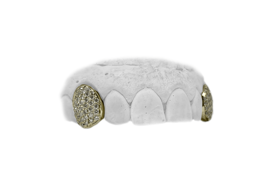 Top Diamond Fang Grillz in Yellow Gold