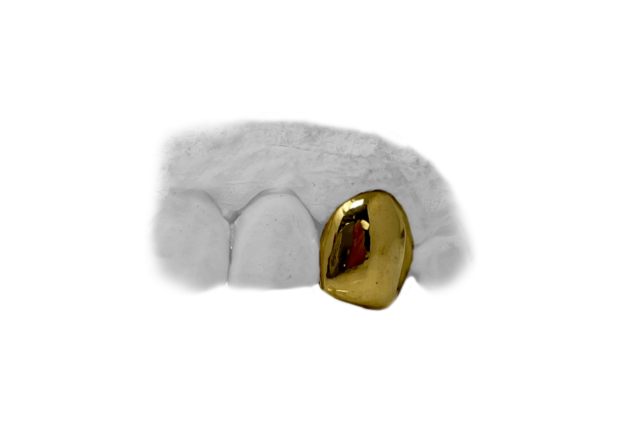 24K Fang Grillz - Top Single Gold Tooth