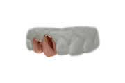 Rose Gold Two Teeth Grillz 14K Double Cap
