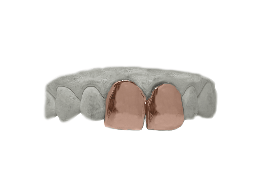 Top Two Front Teeth Grillz in 14K Rose Gold
