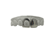 Top Two Front Teeth Grillz in 18K White Gold - (Open Face + Solid)