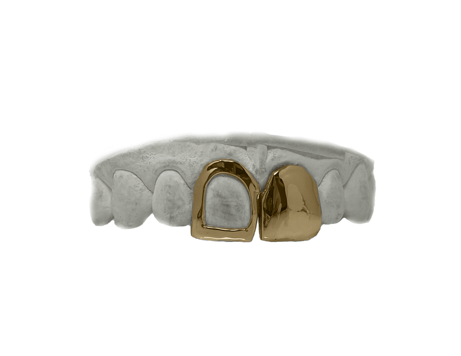 Top Two Front Teeth Grillz in 18K Yellow Gold - (Open Face + Solid)