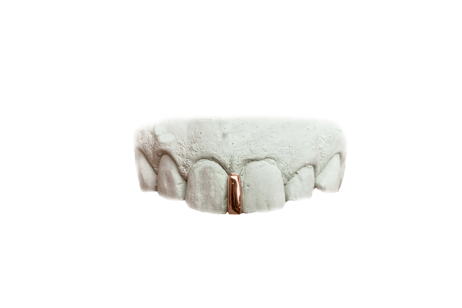 Gap Grillz in 10K Rose Gold