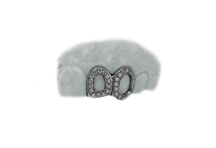 Two Open Face Diamond Teeth in White Gold