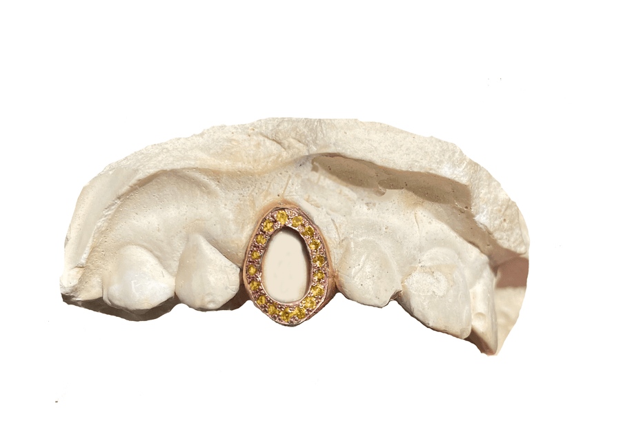 Open Face Yellow Sapphire Grillz on Rose Gold