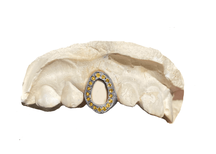 Open Face Yellow Sapphire Grillz on White Gold